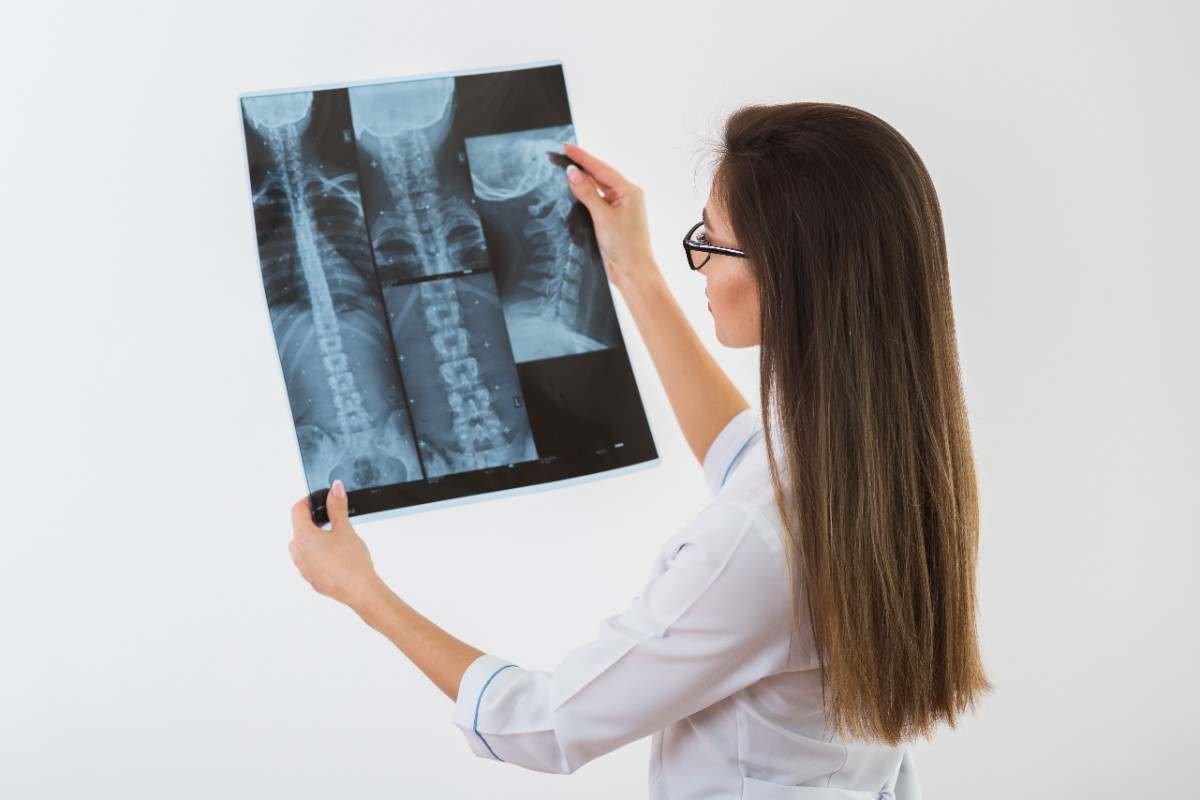 Digital X-Ray