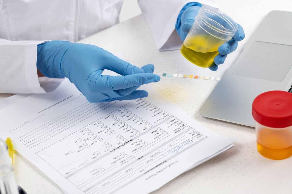 Urine Routine Test